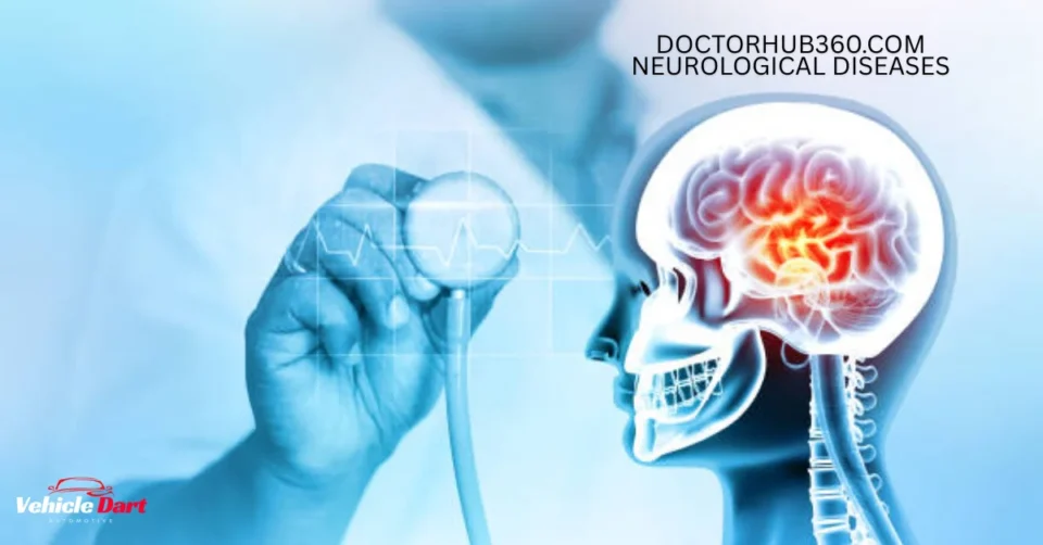 doctorhub360.com neurological diseases